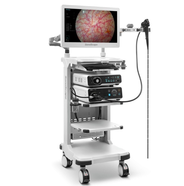 醫(yī)療內(nèi)窺鏡 醫(yī)療內(nèi)窺鏡