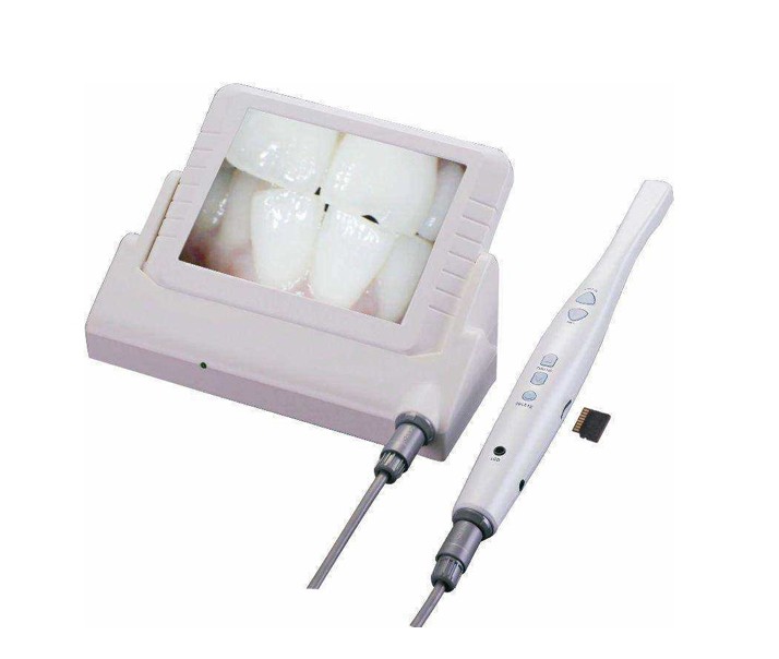 口腔內(nèi)窺鏡 口腔內(nèi)窺鏡