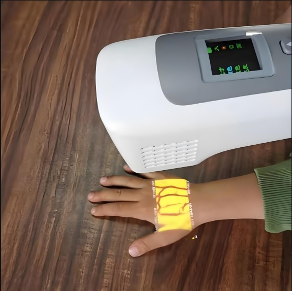 靜脈顯像儀 靜脈顯像儀