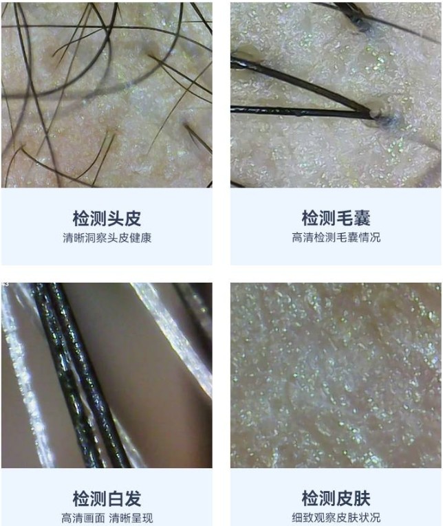 頭皮檢測儀的功能效果 頭皮檢測儀的功能效果